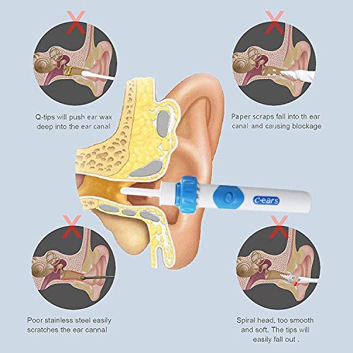 Limpiador de Oídos, Eléctrico Q Grips Limpieza Cerumen Oído, Kit Limpiador para Oídos, Seguro y Suave, con 2 Puntas Lavables, Seguro y Suave, para Niños y Todo tu Familia - Azul