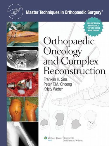 Master Techniques in Orthopaedic Surgery: Orthopaedic Oncology and Complex Reconstruction (English Edition)