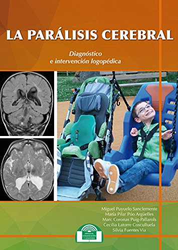 Paralisis cerebral. Diagnostico E Interv: 9 (Lenguaje, Comunicación y Logopedia)