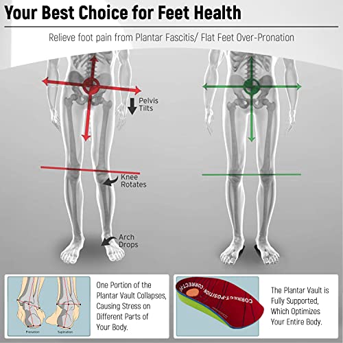 Plantillas ortopédicas de 3/4 con soporte para el arco: inserciones de calzado de amortiguación para la fascitis plantar, pies planos, dolor del talón para hombres y mujeres (1, M: 39/41 EU)