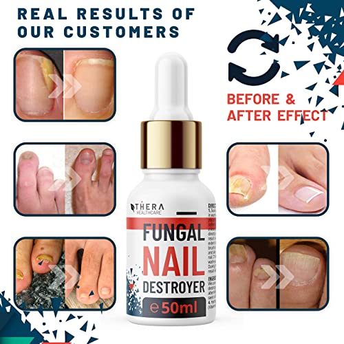 Prima Tratamiento de hongos para las uñas Fungal Nail Destroyer, Apto para Hongos Uñas Pies y Manos | Contiene Aceite del Arbol de Te y Aceite de Argán | 30ml | Lima y Cepillo de Uñas Gratis.