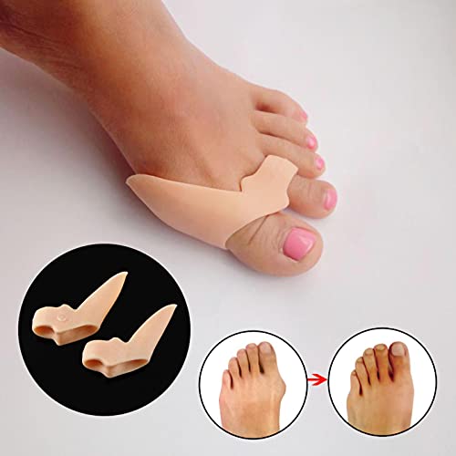 SHIYONG 2 Piezas pie Hallux Valgus ortesis Dedos de los pies Plantilla Separador superpuesto Herramienta para el Cuidado de los Dedos Separador de Dedos