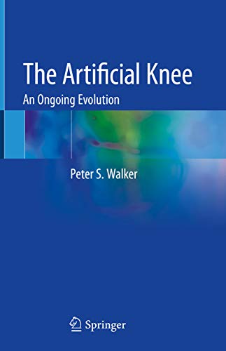 The Artificial Knee: An Ongoing Evolution (English Edition)