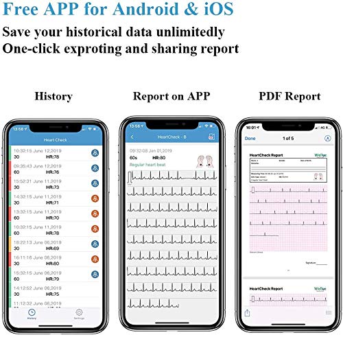 ViATOM Monitor de ECG, Monitor Cardíaco con ECG, Dispositivo Cardíaco Bluetooth con iOS y Aplicación Android, Funciona con Smartphone y PC, Conveniente Monitor Portátil de Ritmo Cardíaco