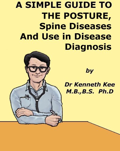 A Simple Guide to The Posture, Spine Diseases and Use in Disease Diagnosis (A Simple Guide to Medical Conditions) (English Edition)