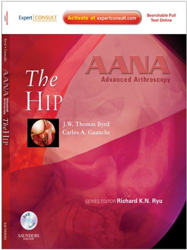 AANA Advanced Arthroscopy: The Hip: Expert Consult: Online, Print and DVD (English Edition)