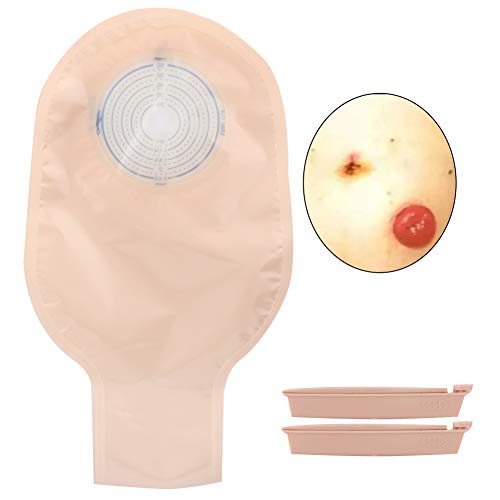 Bolsa de colostomía desechable de 10 piezas Bolsas drenables Bolsa de bolsa de ostomía suave para la piel Bolsa de ostomía con cierre para colostomía Ileostomía Cuidado del estoma Tipo abierto