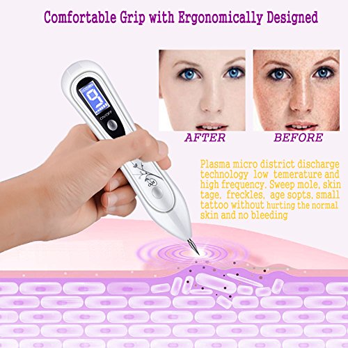 BUDDYGO Manchas Cara Eliminación, Spot Eraser Pro, Skin Tag Mole Remover Pen Intensidad de 9 Niveles para Cara y Cuerpo (Verrugas, Manchas, Mole, Pecas, Tatuajes) Pluma de Pecas con Led Luz