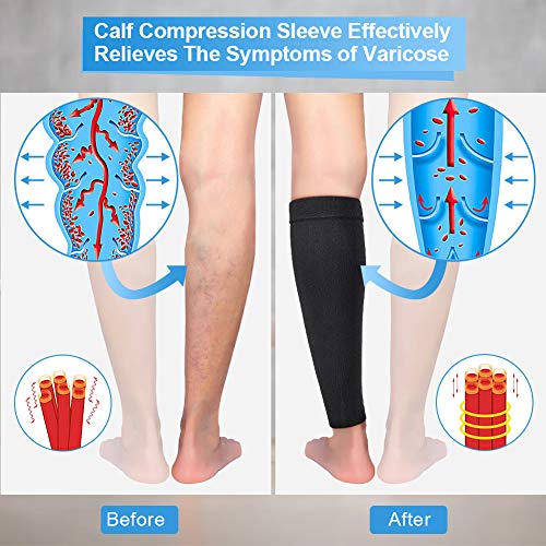 Calcetines de compresión para hombres y mujeres, protector de pantorrilla (20-30 mmHg), mangas de compresión para piernas para soporte de piernas, correr, viajar, deportistas hombres y mujeresXL