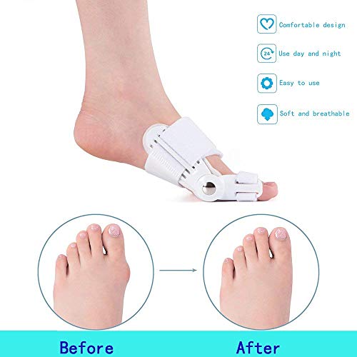 Corrector de juanetes (Hallux Valgus), 2 unidades, almohadilla de férula ortopédica, separador de dedos, ajustable, para hombres y mujeres