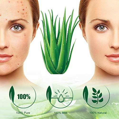 Crema Acne,Acne Tratamiento,Crema de Hierbas para el acné,Reducir los Puntos negros, Equilibrar el Agua y el Aceite, la Crema Contra el Acné Espinilla, Regenera la piel