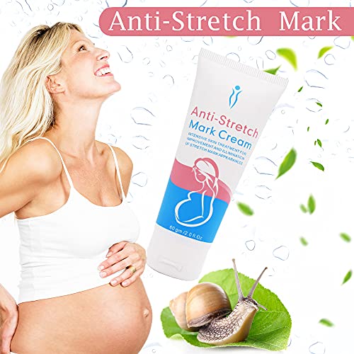 Crema para Estrías, Eliminar Cicatrices del Embarazo, Stretch Marks Cream, Loción corporal, Crema Corporal Anti Estrías, Reparadora y cicatrizante estrías,Estrías Eliminación