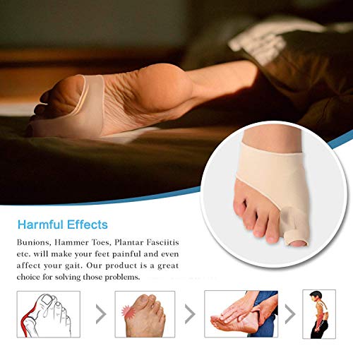 Doact Corrector de Juanetes Férula para Juanete Protector Alivio Dolor del protector dedo pie Pie, Hallux Valgus - Hombres y Mujeres(1 par) (Beige)