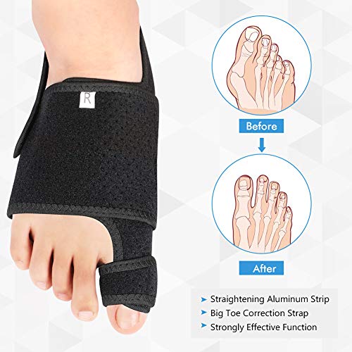 DOACT ortesis de hallux valgus Soporte del arco Gel Férula de noche y día Alisador de dedo gordo para mujeres y hombres Hallux Valgus,Brida de martillo superpuesta,Alivio del dolor del pie plano