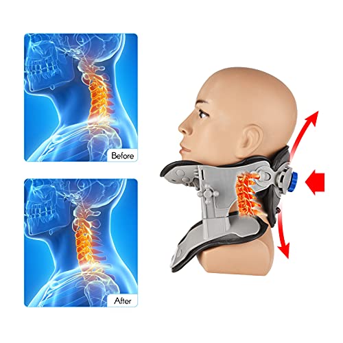 Ksodgun Dispositivo de tracción del cuello cervical Collar extensible de cuello ajustable para una mejor alineación de la columna Alivio y soporte del dolor de cuello