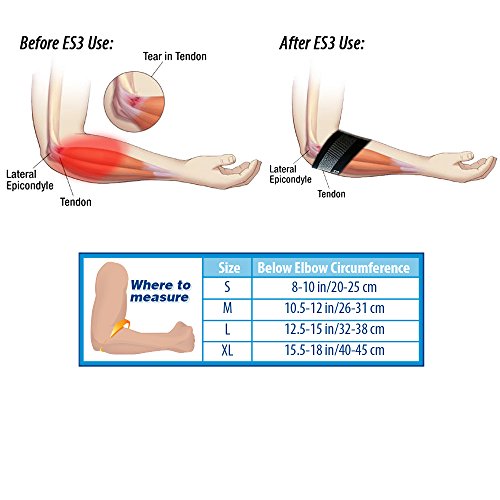 Orthosleeve manga para epicondilitis compresión graduada ES3, Negro, talla M - 3 zonas de compresión - Corrector del codo de tenista - Reduce el dolor en el codo y el antebrazo - Reduce la inflamación