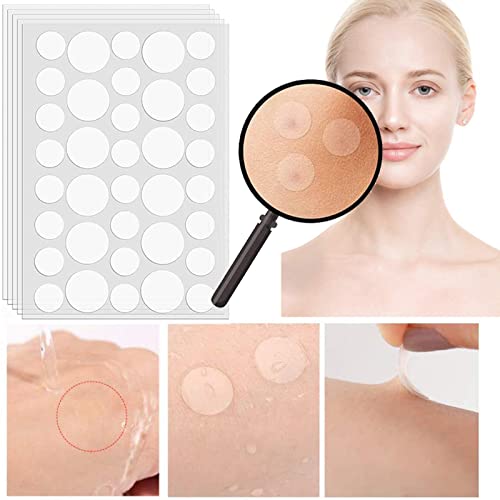 Rpanle Parches Acne, 180 Piezas Uso Diurno y Nocturno Parches Acne 2 en 1, Invisibles Parches Hidrocoloides Para el Acné de 8/12 mm,Impermeable y Transpirable Parches de Acné