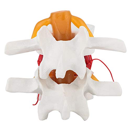 Anatomía humana, 1: 1.5 Modelo de demostración de hernia de disco lumbar humano del modelo de columna vertebral lumbar para demostración médica