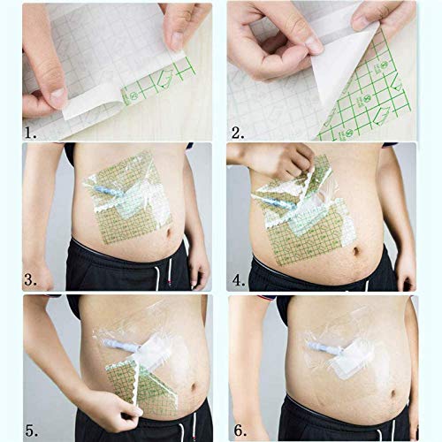 Baño Abdominal Impermeable Película De La Bolsa, Escudo Peritoneal De Ducha Impermeable Desechable, Catéter Barrera De Agua, Productos De Cuidado Especial Para Diálisis Peritoneal Pacientes, 50Pcs