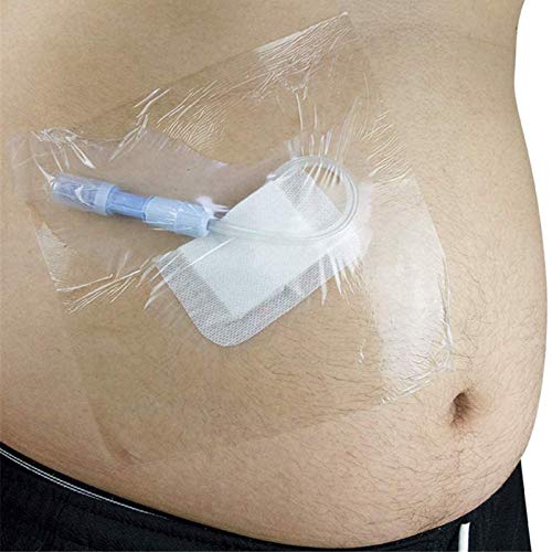 Baño Abdominal Impermeable Película De La Bolsa, Escudo Peritoneal De Ducha Impermeable Desechable, Catéter Barrera De Agua, Productos De Cuidado Especial Para Diálisis Peritoneal Pacientes, 50Pcs