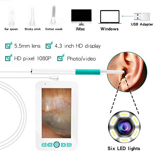 CHENNA USB otoscopio con Pantalla de 4,3 Pulgadas y el oído del endoscopio, 5.5mm otoscopio for Comprobar la cámara, se Niegan a Limpio a ciegas, Conveniente for Muchas Ocasiones