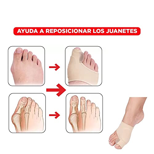 Corrector de Juanetes y Hueso del Pie - Separador de Juanetes del Pie - Protector de Juanetes - Corrector Dedos del Pie de Hallux Valgus - Alivia Dolor de Juanetes para Hombre y Mujer (L 9,5CM)