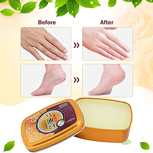 Crema de Manos Reparadora, Crema Anti-agrietamiento, Crema de Manos y pies de Aceite de Caballo Crema, Crema Hidratante para El Cuidado de Los Pies