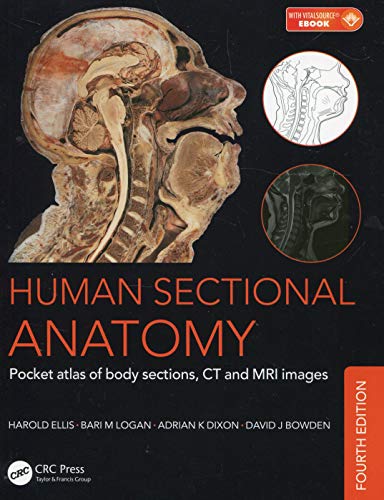 Human Sectional Anatomy: Pocket atlas of body sections, CT and MRI images, Fourth edition