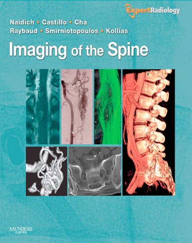 Imaging of the Spine: Expert Radiology Series (English Edition)