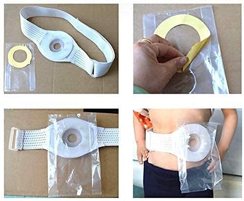 Joyfitness Cinturón Unisex para Hernia De Abdomen, Encuadernador De Estómago Soporte De Ostomía Apertura De Estoma Transpirable Ajustable, para Pacientes con Colostomía Enfermería Posoperatoria