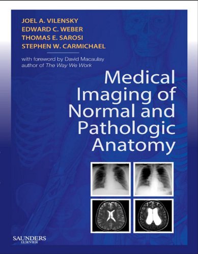 Medical Imaging of Normal and Pathologic Anatomy E-Book (English Edition)