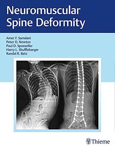 Neuromuscular Spine Deformity: A Harms Study Group Treatment Guide