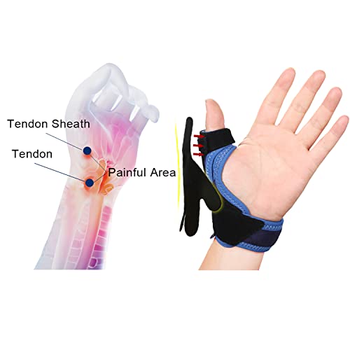 Protector De Pulgar para Tenosinovitis para Mano De Ratón, Férula Ligera Y Transpirable para Manos Izquierda Y Derecha, 1 Pieza