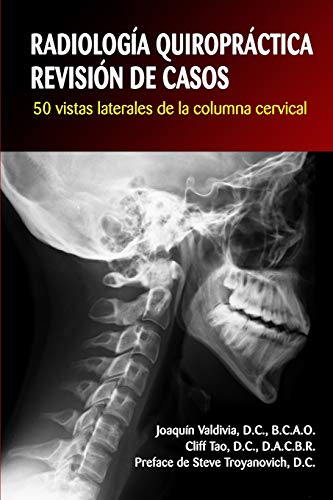 RADIOLOGÍA QUIROPRÁCTICA: REVISIÓN DE CASOS. 50 vistas laterales de la columna cervical