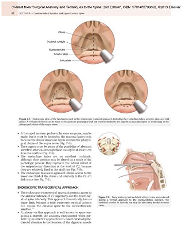 Surgical Anatomy and Techniques to the Spine: Expert Consult - Online and Print, 2e