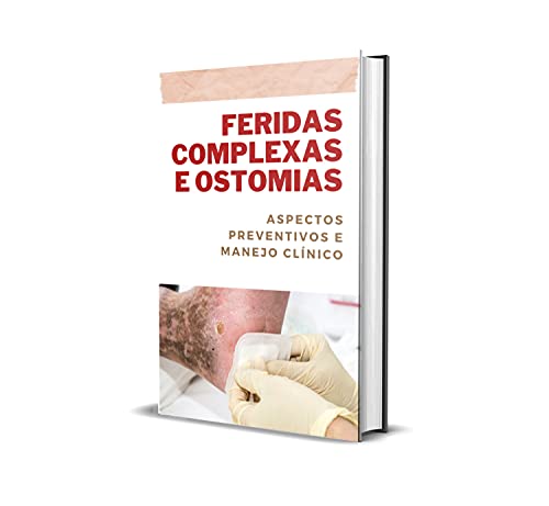 Tratamento de feridas complexas e ostomias: Aspectos preventivos e manejo clinico (Portuguese Edition)