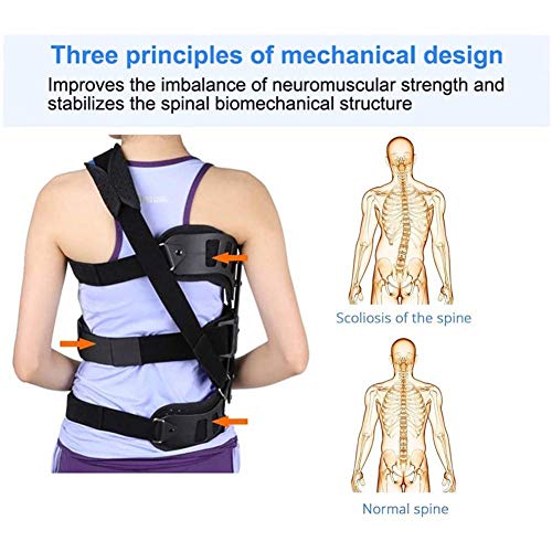 WEDF Corrector de Postura de Espalda para escoliosis posoperatoria