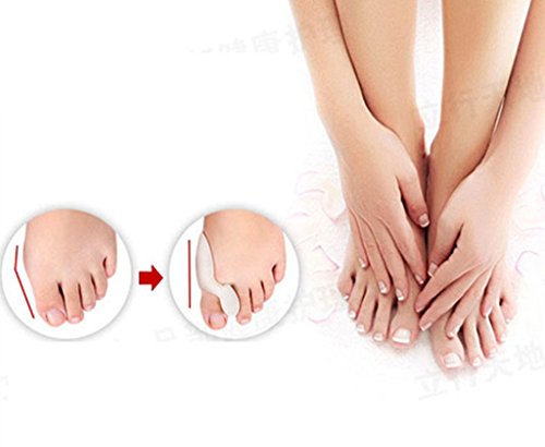 4 PicuMed separador de dedos de silicona Soft Gel Hallux Valgus Martillo Corrección para juanete en calidad premium Tratamiento Prevención (4 unidades = 2 pares)