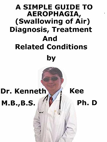 A Simple Guide To Aerophagia, (Swallowing of Air) Diagnosis, Treatment And Related Conditions (English Edition)