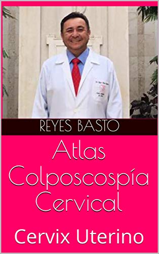 Atlas Colposcospía Cervical: Cervix Uterino