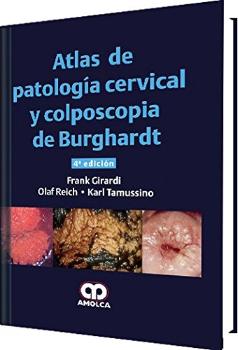 ATLAS DE PATOLOGIA CERVICAL Y COLPOSCOPIA DE BURGHARDT