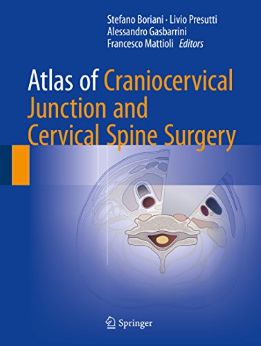 Atlas of Craniocervical Junction and Cervical Spine Surgery (English Edition)