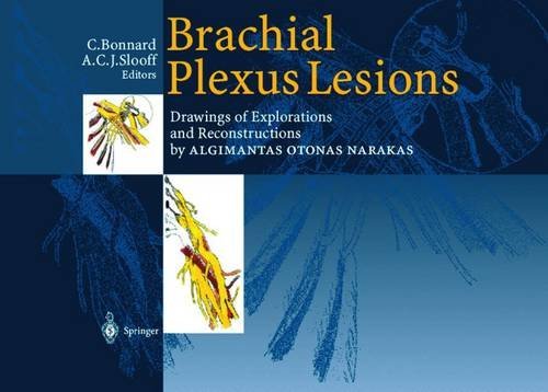 Brachial Plexus Lesions: Drawings of Explorations and Reconstructions by Algimantas Otonas Narakas (English Edition)