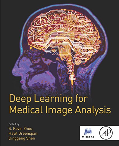 Deep Learning for Medical Image Analysis (The MICCAI Society book Series) (English Edition)