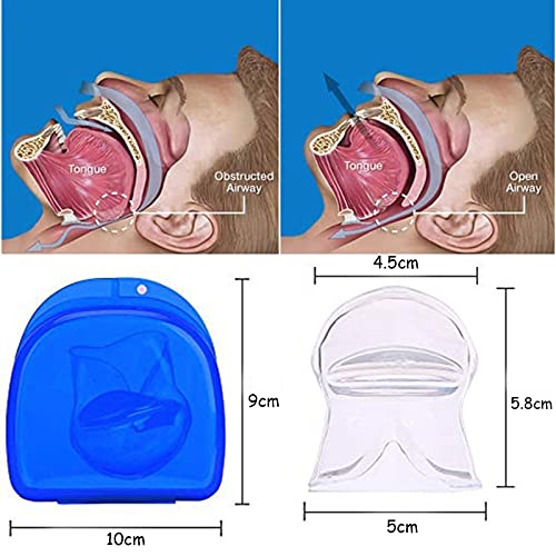 Detener Los Ronquidos, Dispositivos Antirronquidos Para La Lengua De Silicona, Detener La Apnea Del Sueño, Protector Bucal, Retenedor De La Lengua, Dispositivo De Avance Mandibular