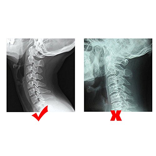 Dispositivo de tracción cervical ajustable, Fijación de tracción Soporte Tracción del cuello sobre la puerta, tracción cervical, fijación, corrección, engranaje, corrección, camilla, alivio del dolor