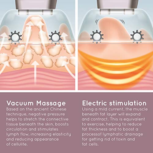 HoMedics Smoothee Masajeador Anticelulítico a Succión con Ventosas de Vacío Intercambiables – Tratamiento Suavizante Contra la Celulitis, Desintoxica la Piel, Activa el Metabolismo - Recargable