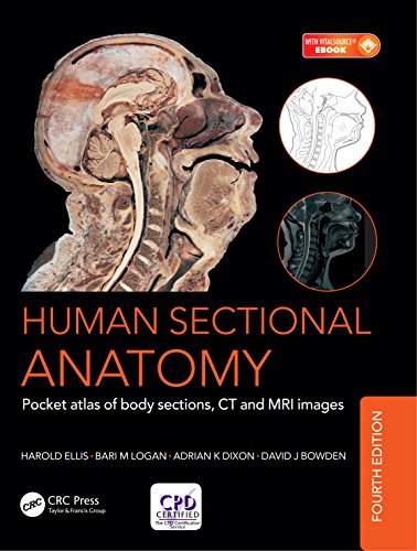 Human Sectional Anatomy: Pocket atlas of body sections, CT and MRI images, Fourth edition (English Edition)