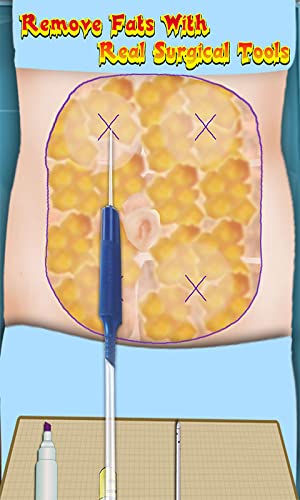 La liposucción Cirugía Simulador