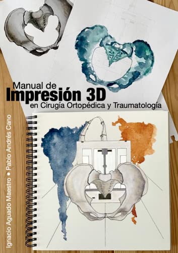 Manual de Impresión 3D en Cirugía Ortopédica y Traumatología